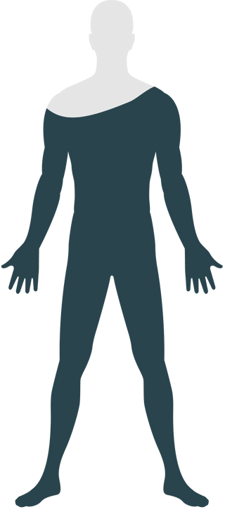 After 3-6 months silhouette